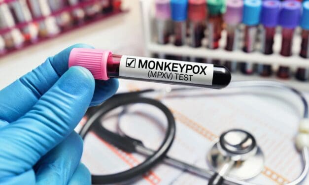 First Confirmed Case of Monkeypox Identified in San Luis Valley