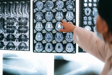 Central Colorado Humanists Sunday Science Program: “How Magnetic Resonance Imaging Works”