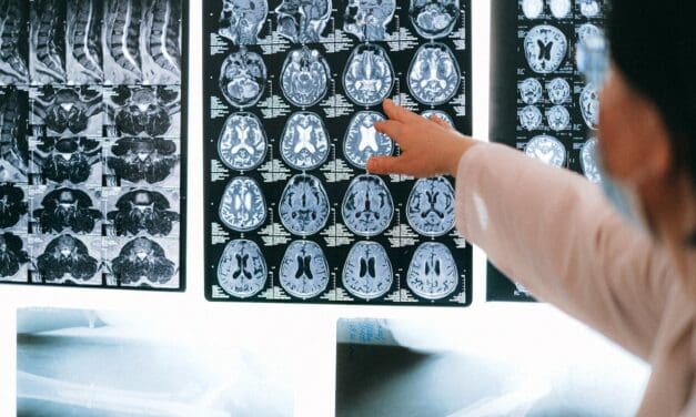 Central Colorado Humanists Sunday Science Program: “How Magnetic Resonance Imaging Works”