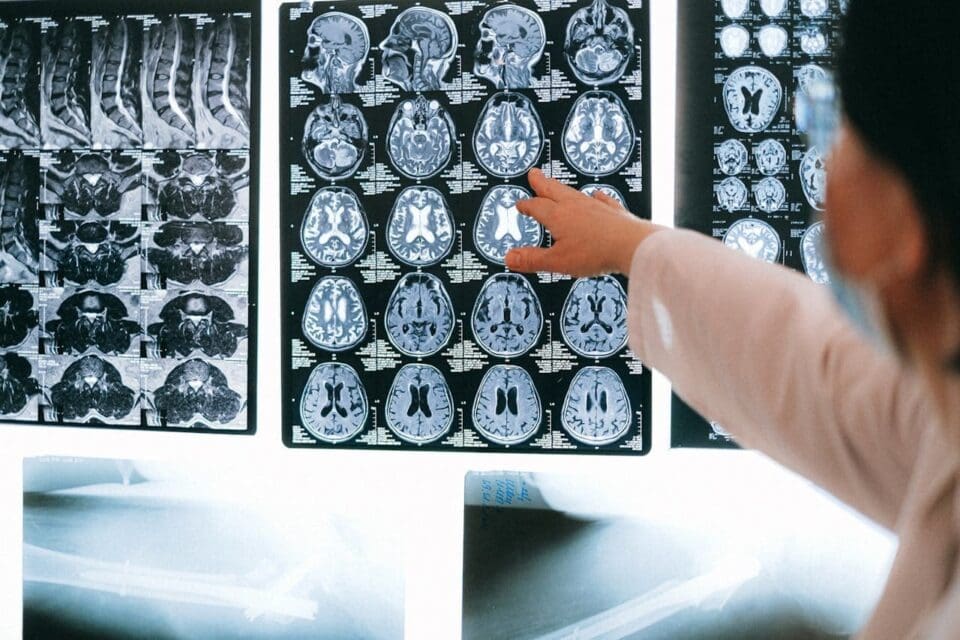 Central Colorado Humanists Sunday Science Program: “How Magnetic Resonance Imaging Works”